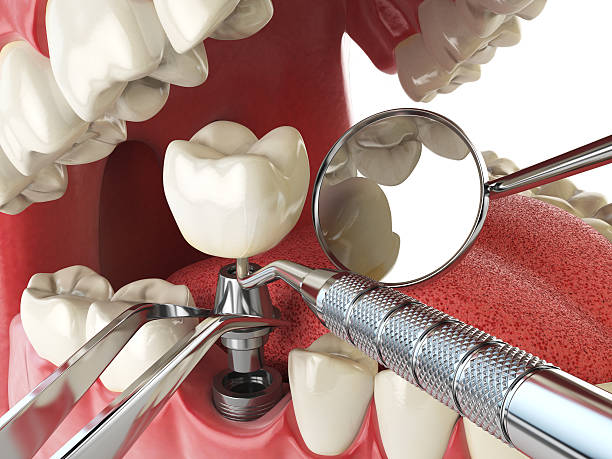 Best Emergency Broken Tooth Repair in Country Lake Estates, NJ